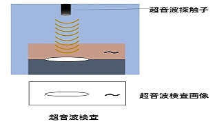 超音波検査,超音波反射波
