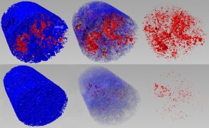 鋳巣（ﾎﾟﾛｼﾃｷ）検出（CT）